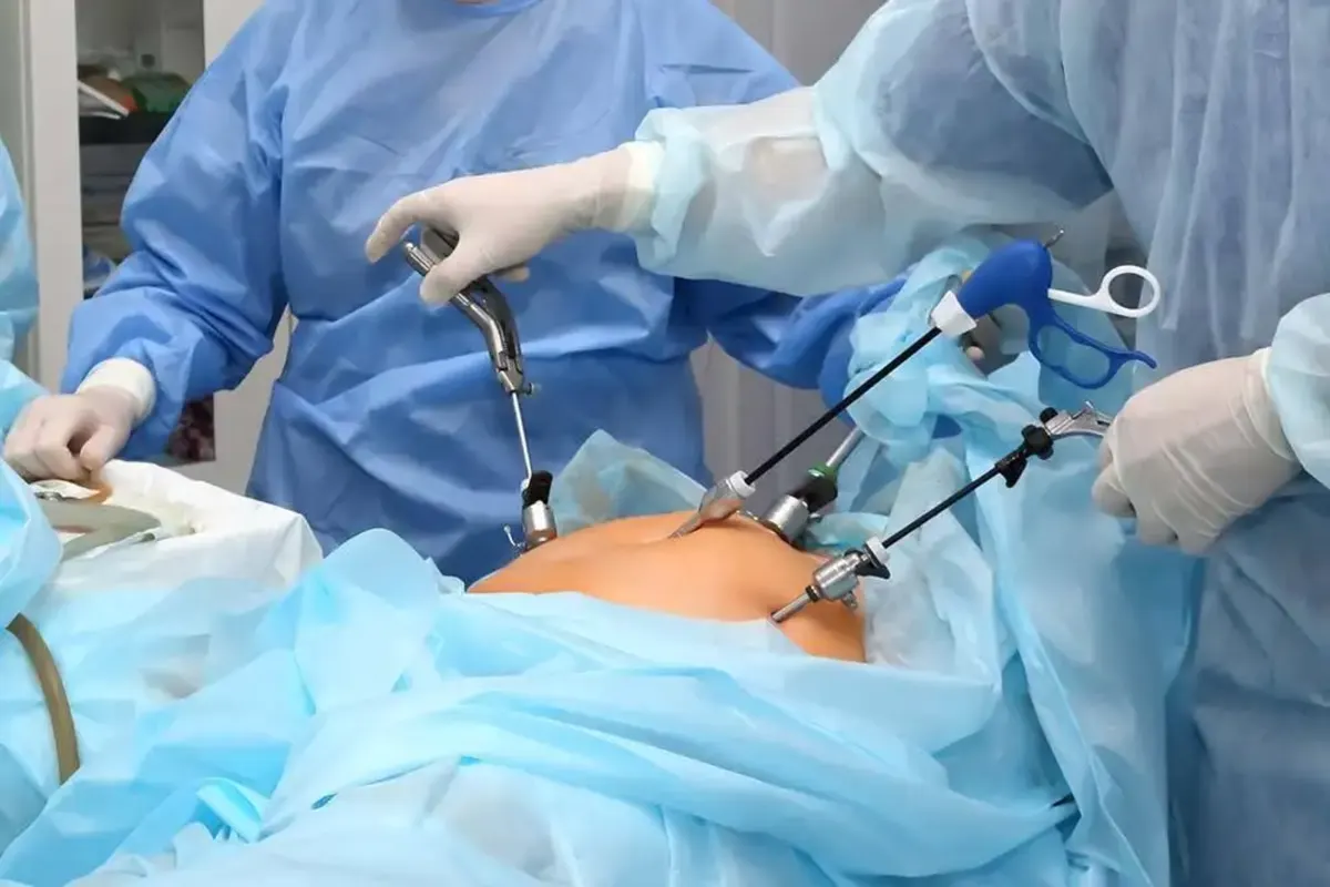 Minimally invasive laparoscopic surgery at AnuSri Hospitals Secunderabad Hyderabad